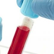 Kanada’da bilim insanları, kanı dönüştüren teknik geliştirdi.